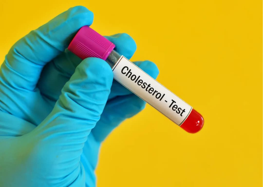 Czego nie jeść przed badaniem cholesterolu, aby uniknąć błędnych wyników