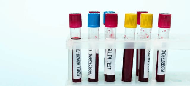 Kiedy wykonać badania hormonalne? Kluczowe dni cyklu dla wyników