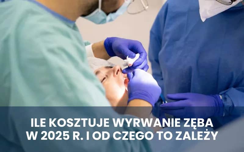 Ile kosztuje wyrwanie zęba u chirurga? Sprawdź ceny i ukryte koszty