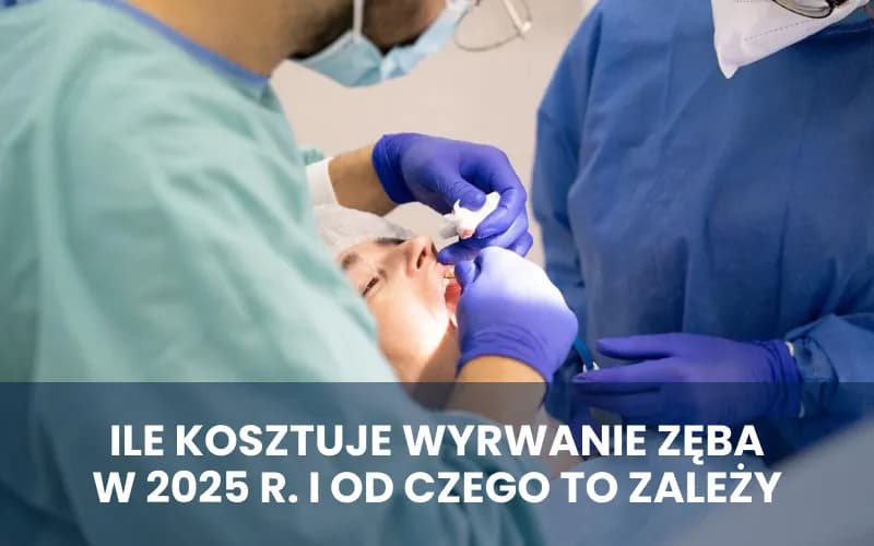 Ile kosztuje wyrwanie zęba u chirurga? Sprawdź ceny i ukryte koszty