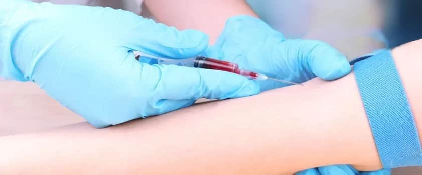 ALAT co to za badanie? Kluczowe informacje o teście wątrobowym