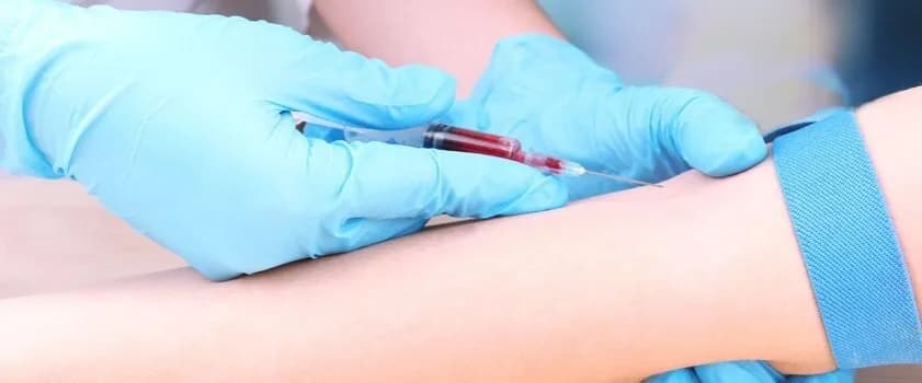 ALAT co to za badanie? Kluczowe informacje o teście wątrobowym