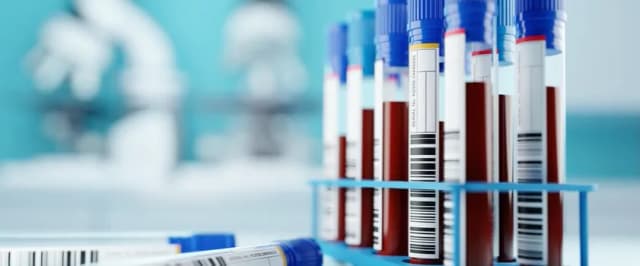 Badanie LDL co to jest - Kluczowe informacje o cholesterolu i zdrowiu