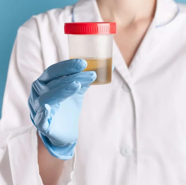 Czego nie robić przed badaniem moczu, aby uniknąć błędnych wyników